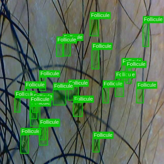 Analyse cuir chevelu au scanner Capilyos