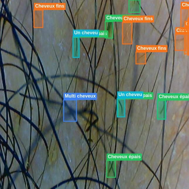 Analyse résistance au scanner Capilyos